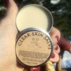 Close-up of acne treatment balm being gently smoothed onto clear skin with fingertips