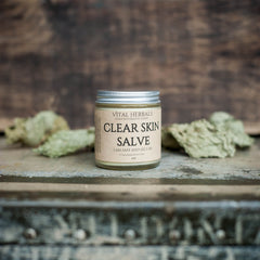 Side view of sleek white acne balm tube with gold accents, showcasing creamy texture dispensed on fingertips