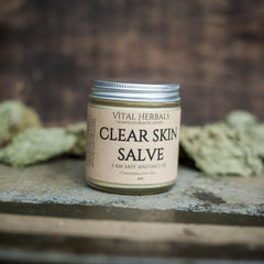 Close-up of creamy acne balm with smooth texture in a sleek white tube, dispensed on fingertips