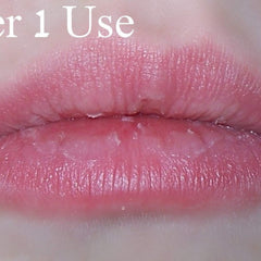 Lip close-up showing pink color, textured surface, and white flakes.