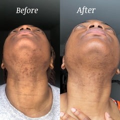 Dark brown African black soap cleanser in a sleek white bottle with minimalist label for oily, sensitive skin