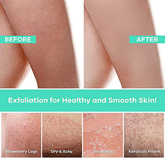 Skin before and after exfoliation, showing light skin tone with visible pores, and smoother skin after treatment, with text labels