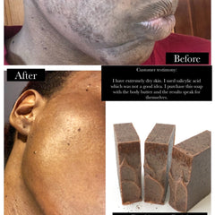 Soap bars with dark brown color, textured surface, and rectangular shape, shown with before/after skin images