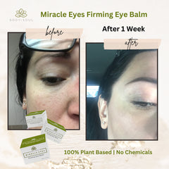 Eye balm comparison, two side-by-side photos of a face, with text "before" and "after" on a light background.