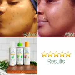 Skin treatment before and after, showing skin tone change, with "Before" and "After" text, and B.E. Herb'd bottles