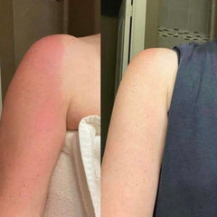 Close-up of hands applying rich body butter from a white tube onto smooth, hydrated skin