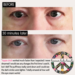 Eye area comparison before and after, showing skin texture and eye color, with Boomer Babe Beauty logo