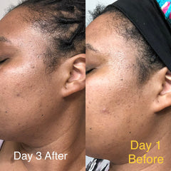Skin comparison showing side-by-side view of skin before and after, with visible skin texture and text labels