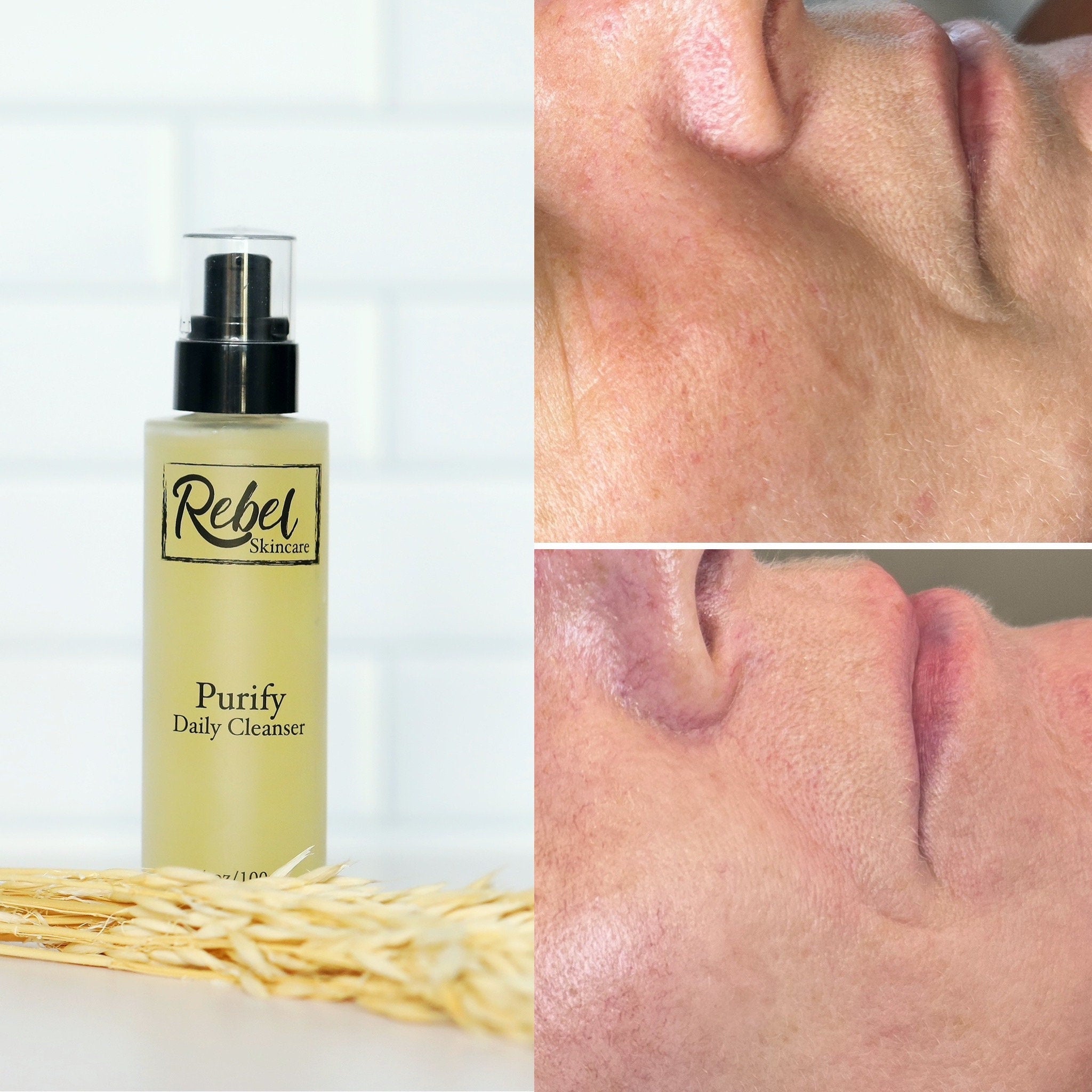 Facial Cleanser bottle with black pump, yellow liquid, and Rebel Skincare label next to skin comparison