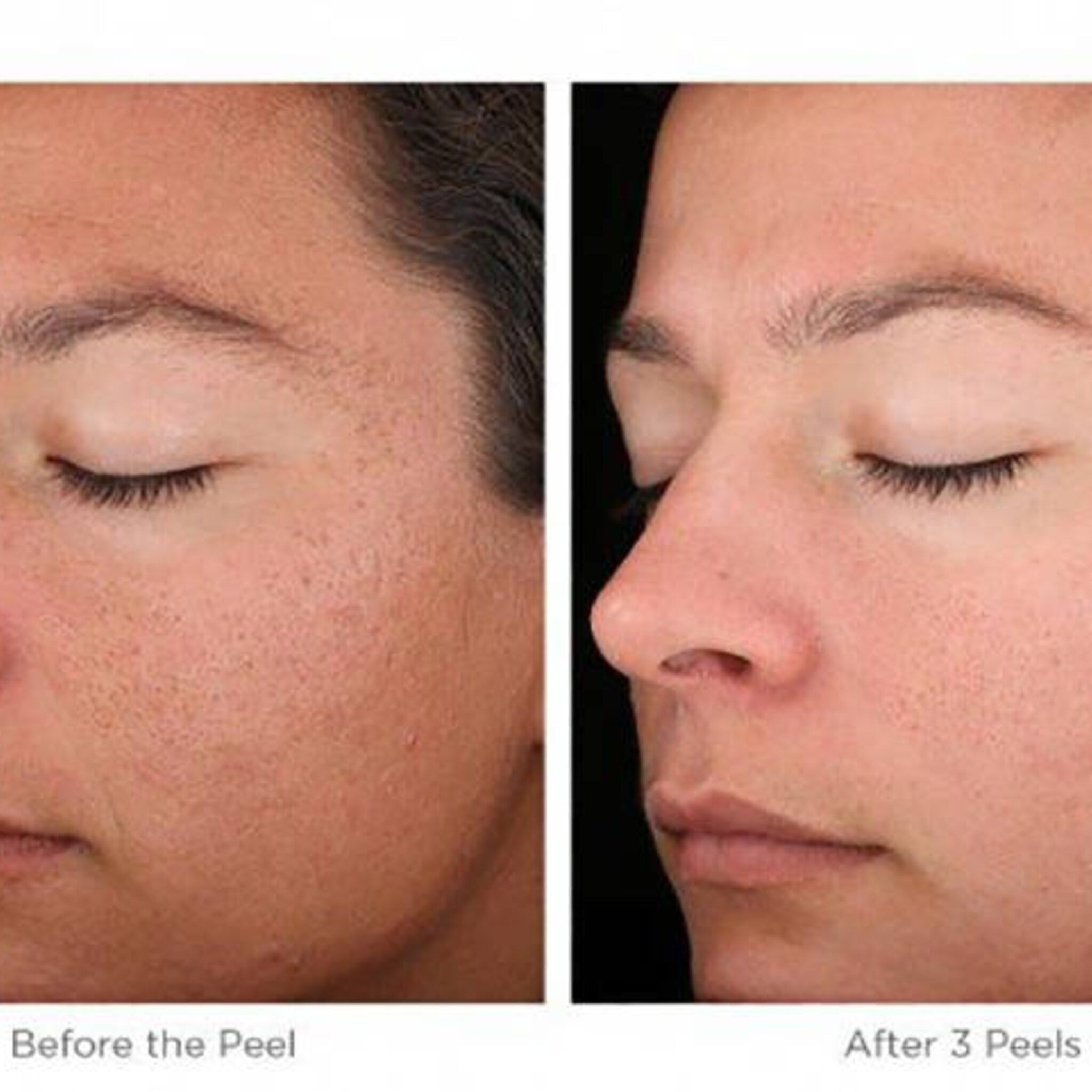 Skin treatment comparison showing skin before and after, skin tones, closed eyes, and facial features