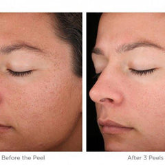 Skin treatment comparison showing skin before and after, skin tones, closed eyes, and facial features
