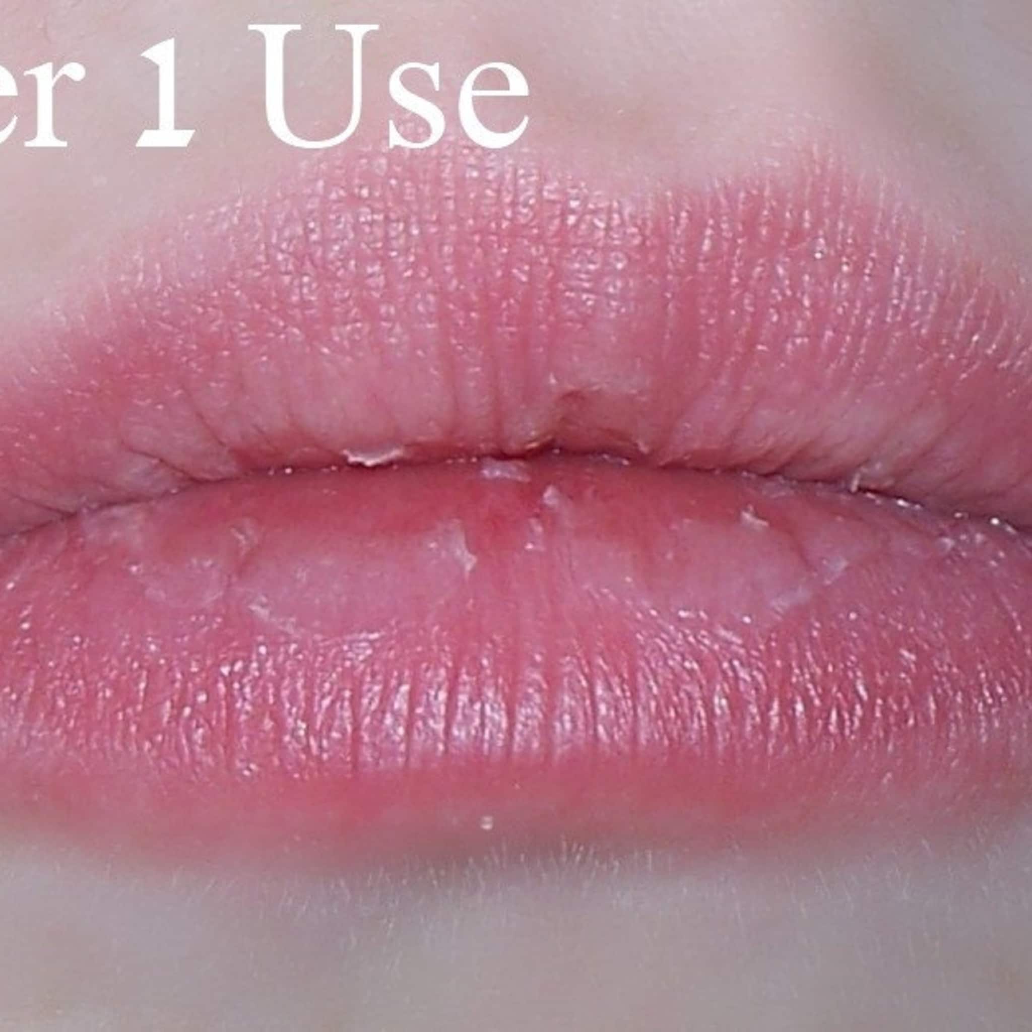 Lip close-up showing pink color, textured surface, and white flakes.