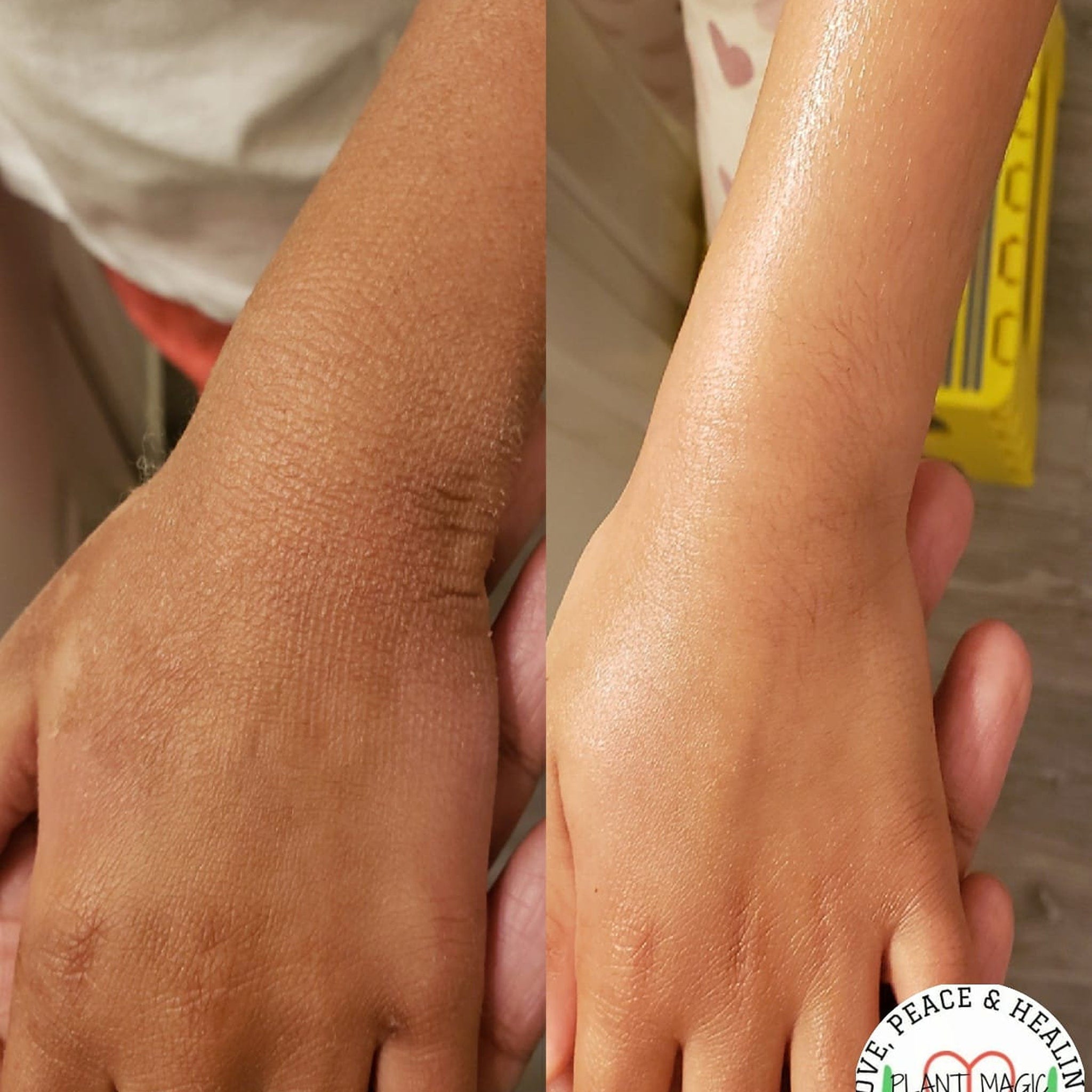 Dry skin comparison, brown skin, before and after treatment, Plant Magic logo visible