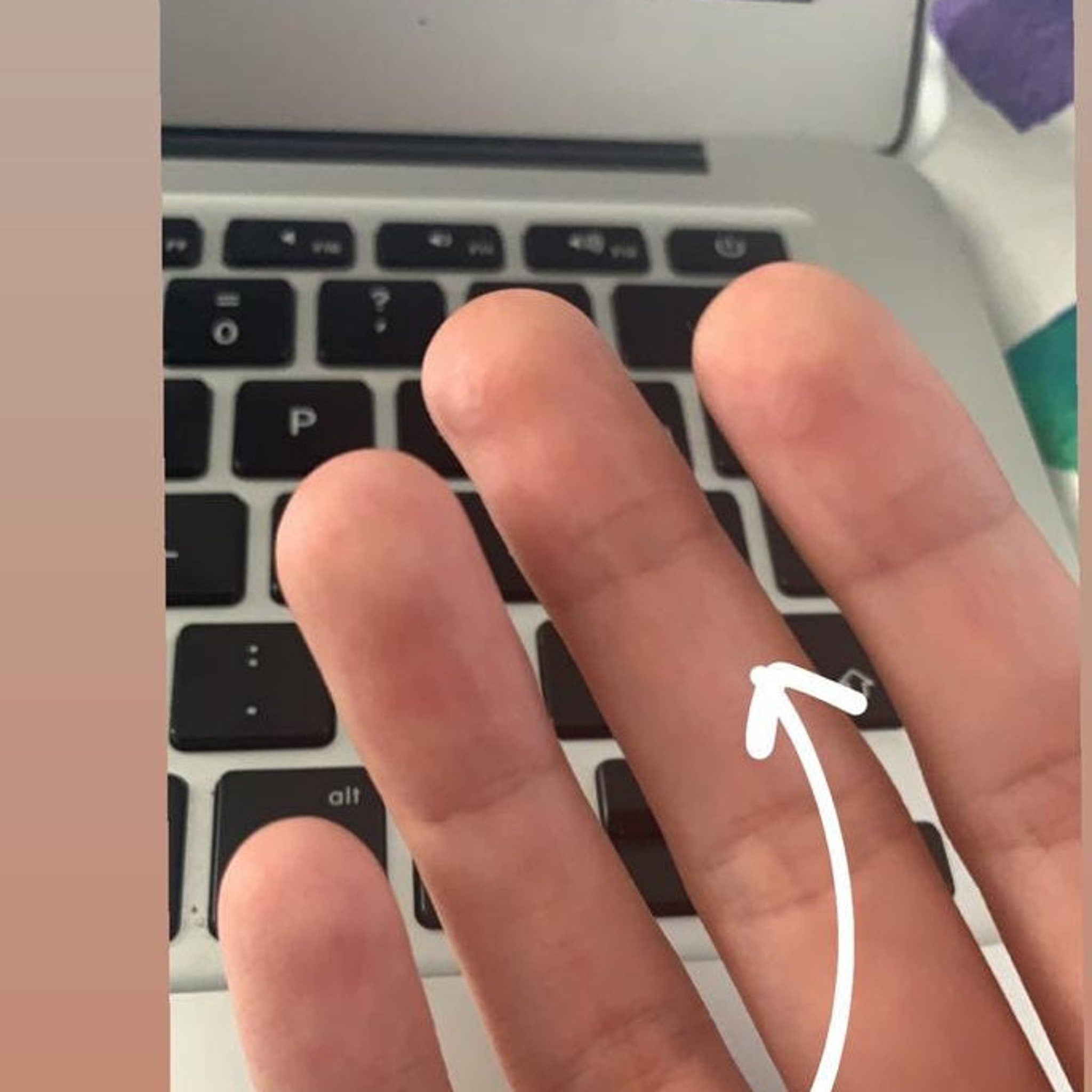 Fingers on keyboard, light skin tone, black and white keys, white arrow pointing up