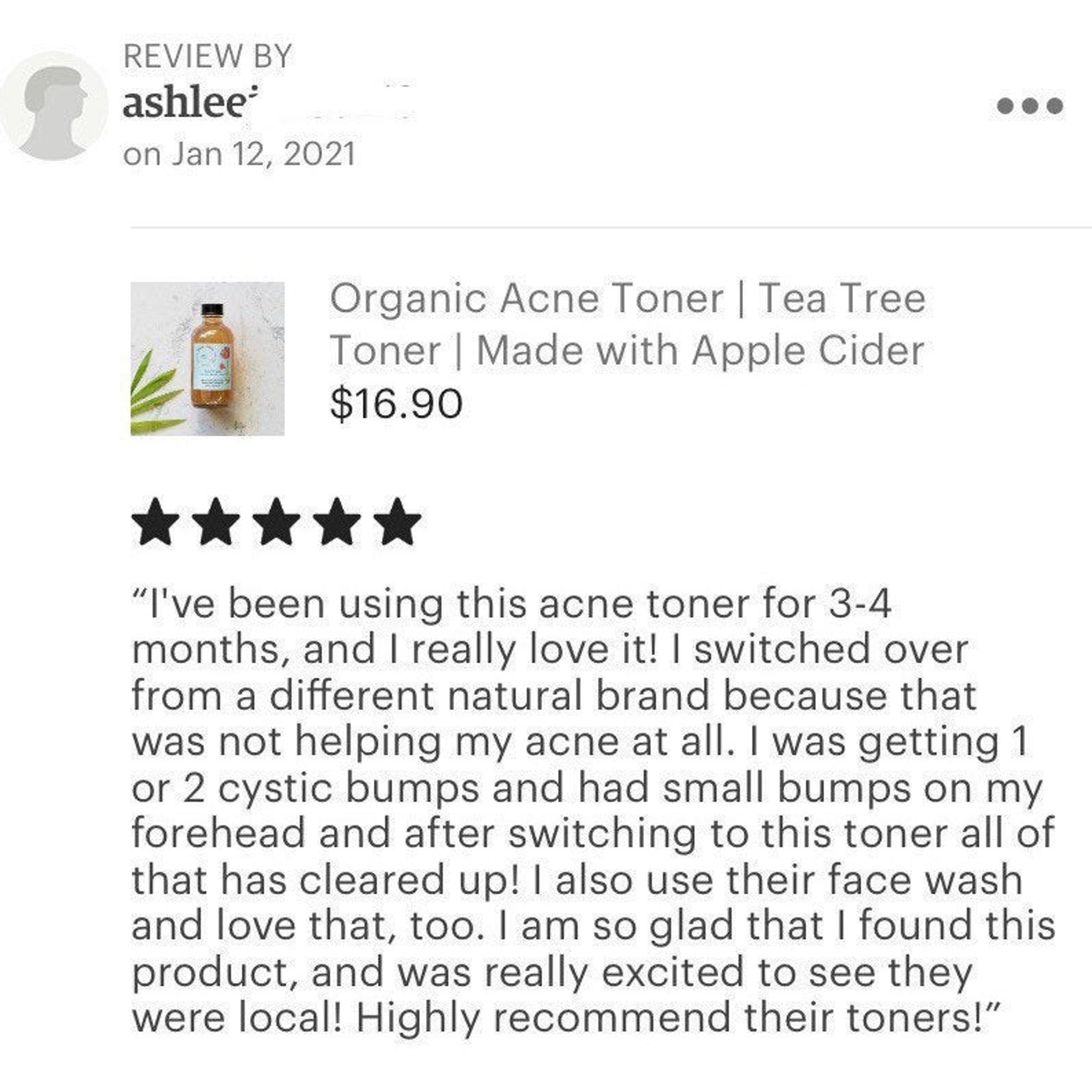 Acne toner review with brown bottle, black cap, and blue label, with five star rating