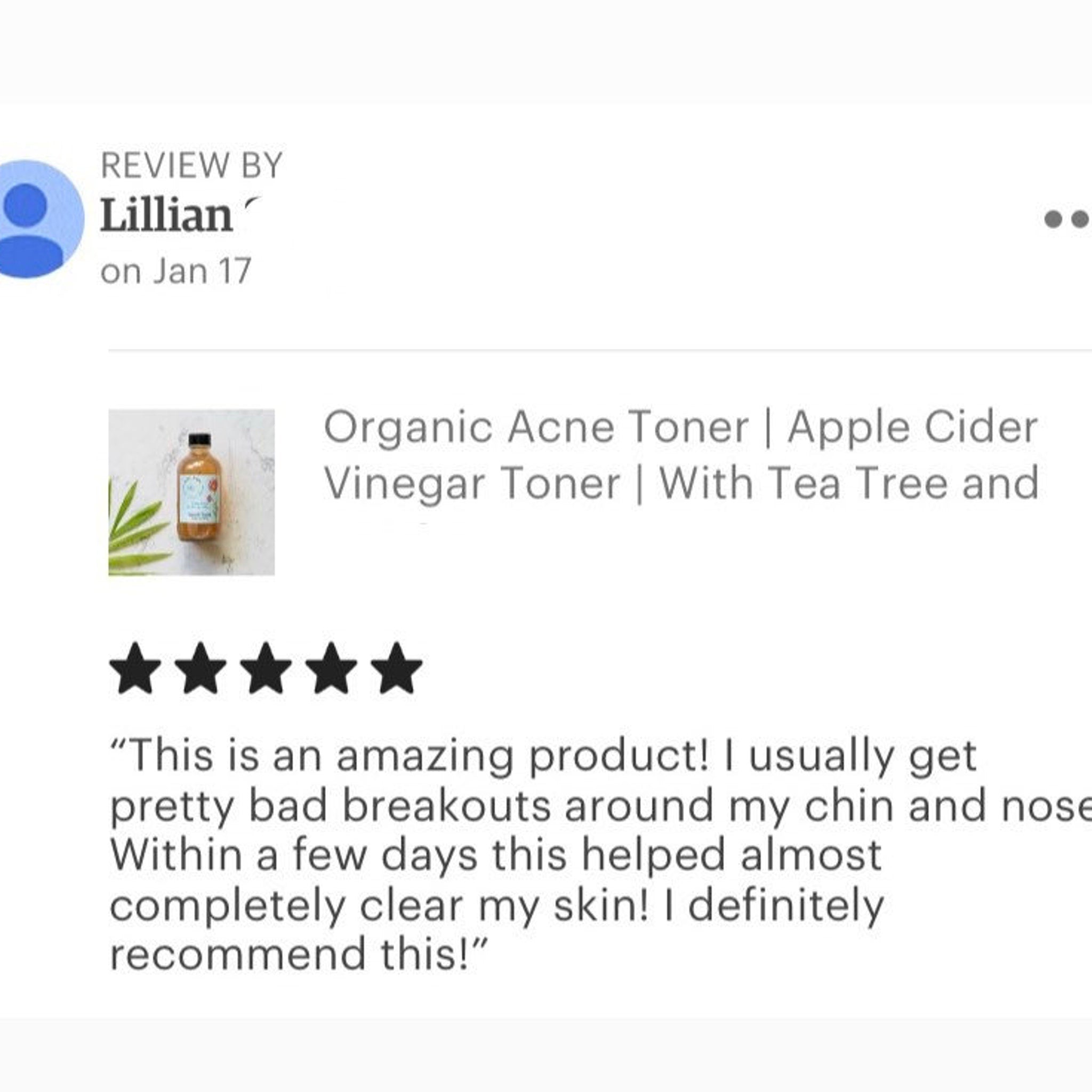 Acne toner review with five star rating, product bottle and customer quote about skin care