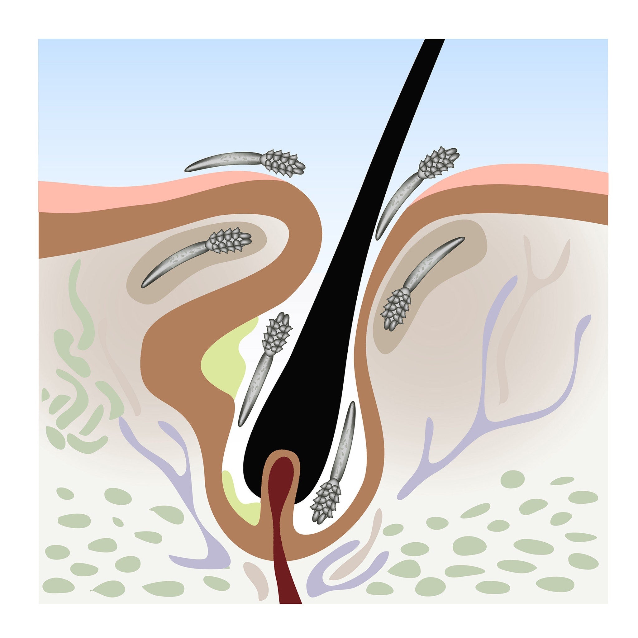 Hair follicle illustration with black hair, gray spiky structures, and skin layers in brown and pink tones