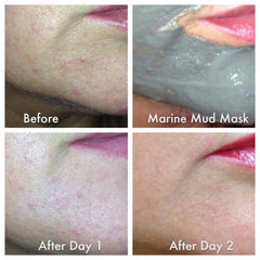 Marine Mud Mask application on skin, showing grey mask, and skin before and after use