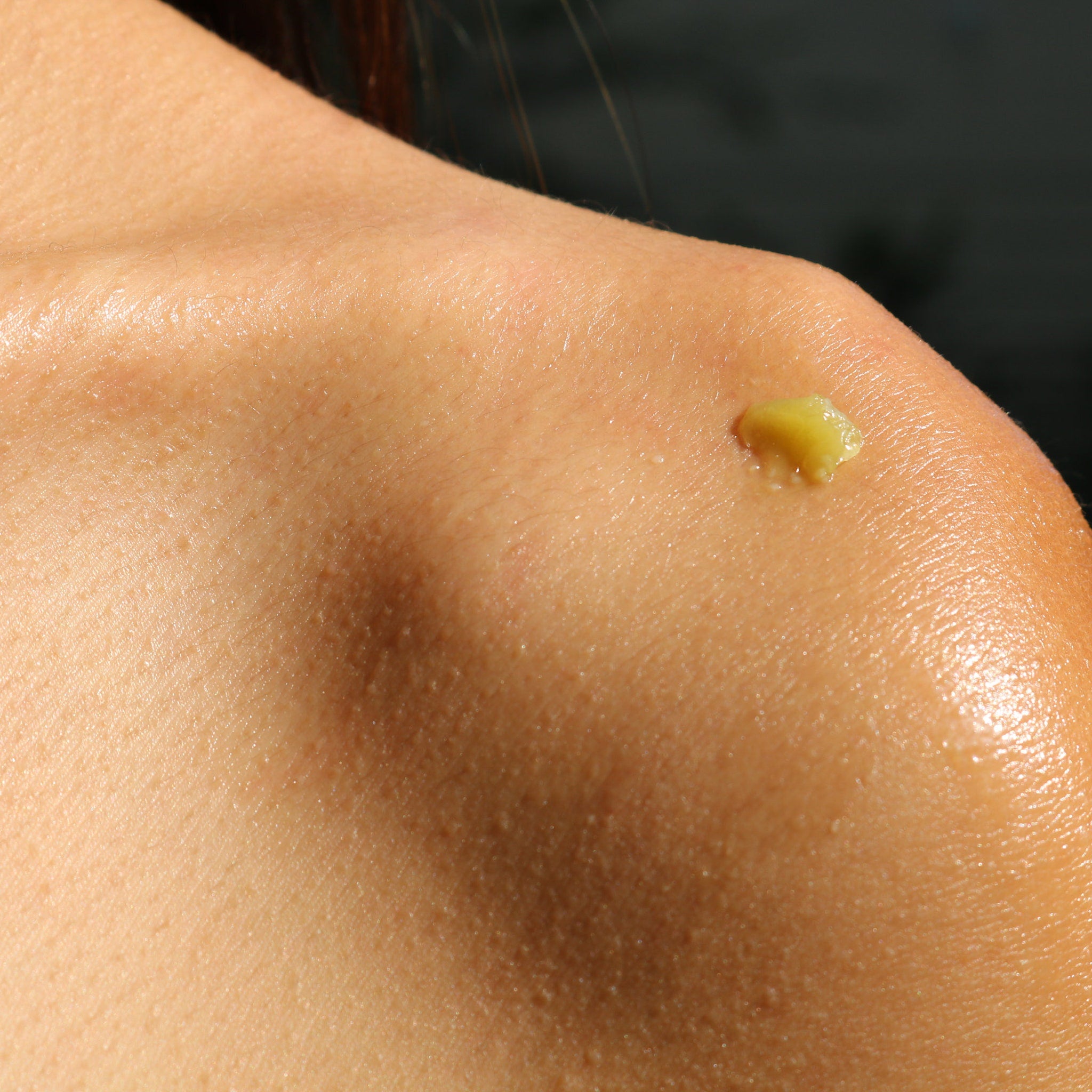Skin with yellow substance, showing brown skin, smooth texture, and dark background