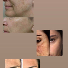 Facial Cleansers before and after skin comparison, with light and dark skin tones, showing skin texture changes