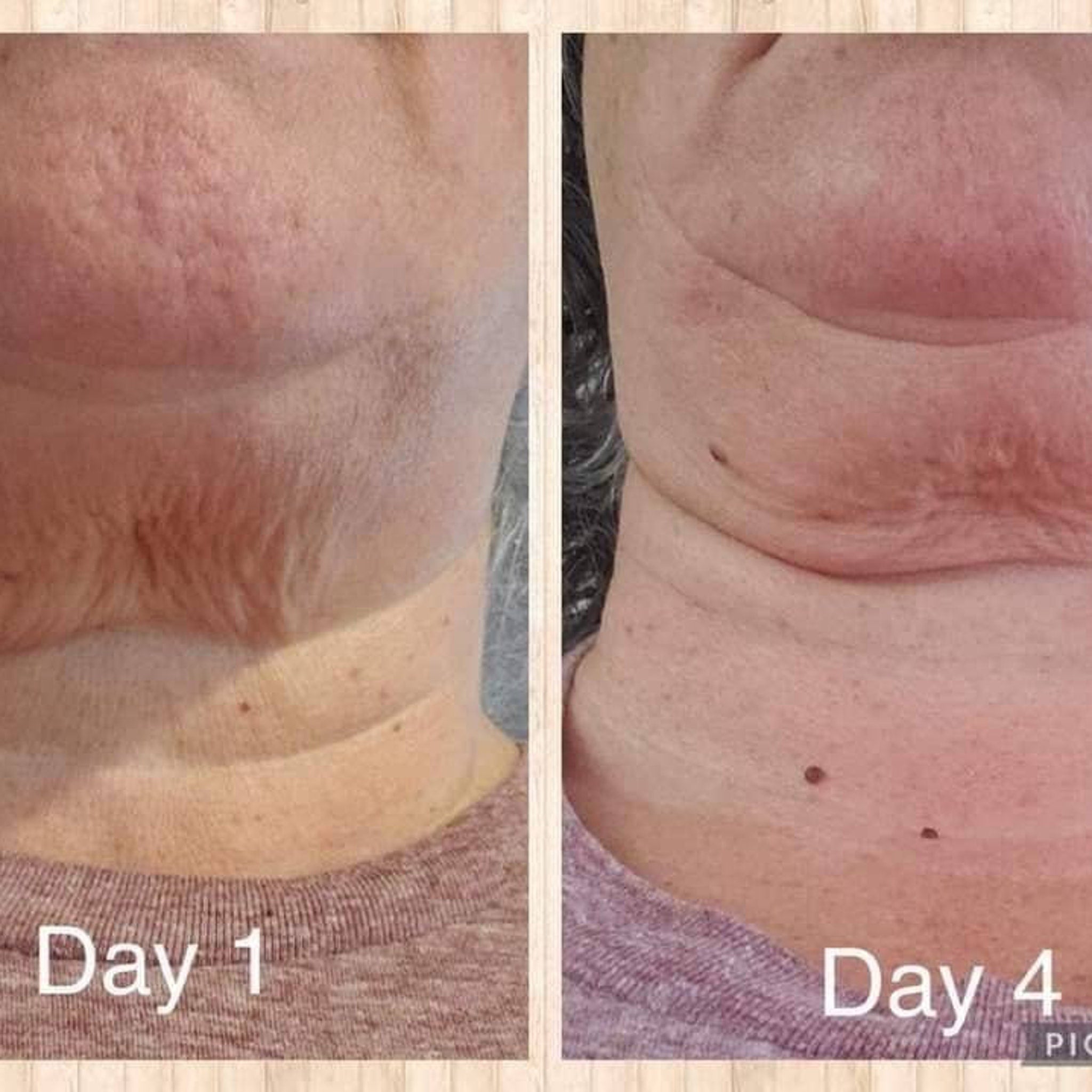 White pump bottle of NuSkin Dermatic Body Contouring Lotion with silver accents on sleek packaging
