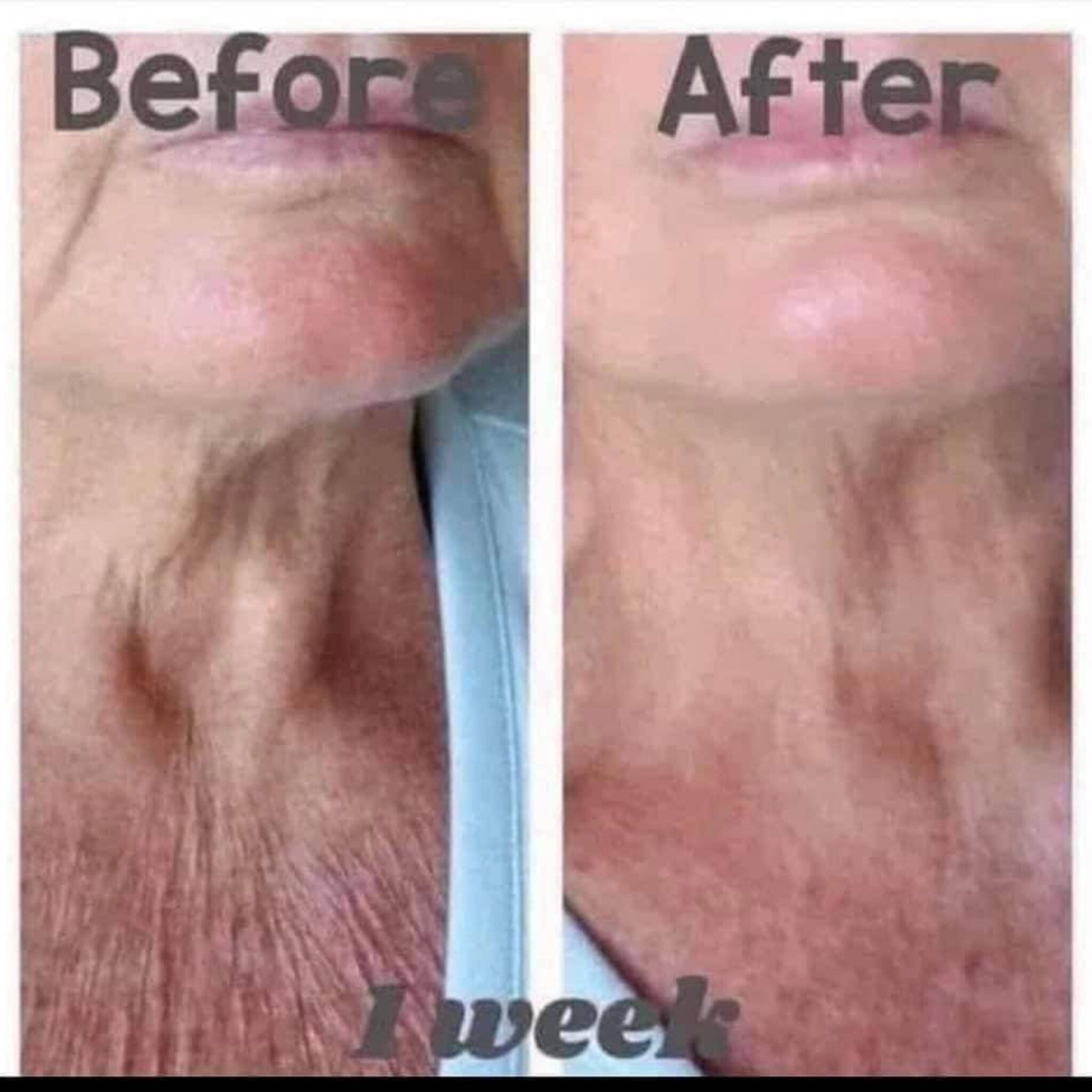 Additional view of NuSkin Dermatic Body Contouring Lotion for Skin Firming