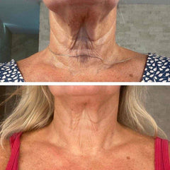 Hand applying NuSkin Dermatic Body Contouring Lotion onto bare skin, showcasing its creamy texture and smooth absorption