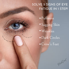 Eye fatigue image with blue eye, skin tone, and dotted lines showing wrinkles and puffiness