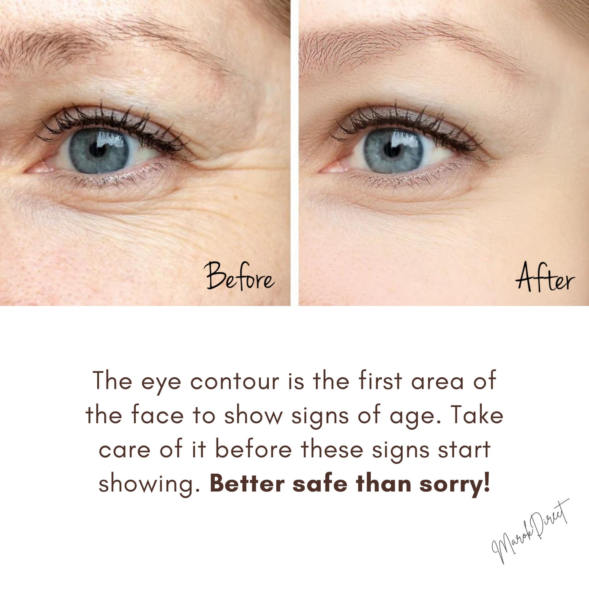 Eye care comparison showing skin with wrinkles before and after treatment, blue eye color visible