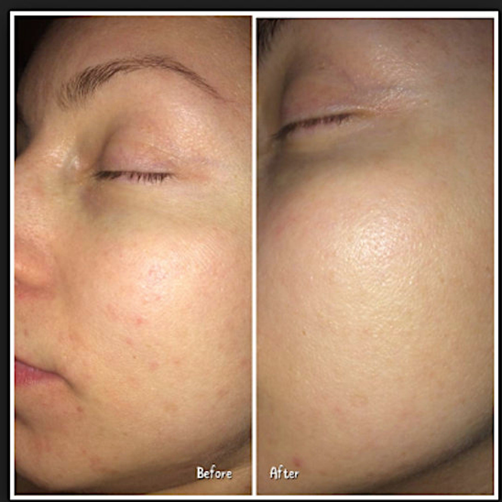 Skin comparison showing before and after, skin tone, texture, and blemishes visible on face