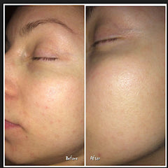 Skin comparison showing before and after, skin tone, texture, and blemishes visible on face
