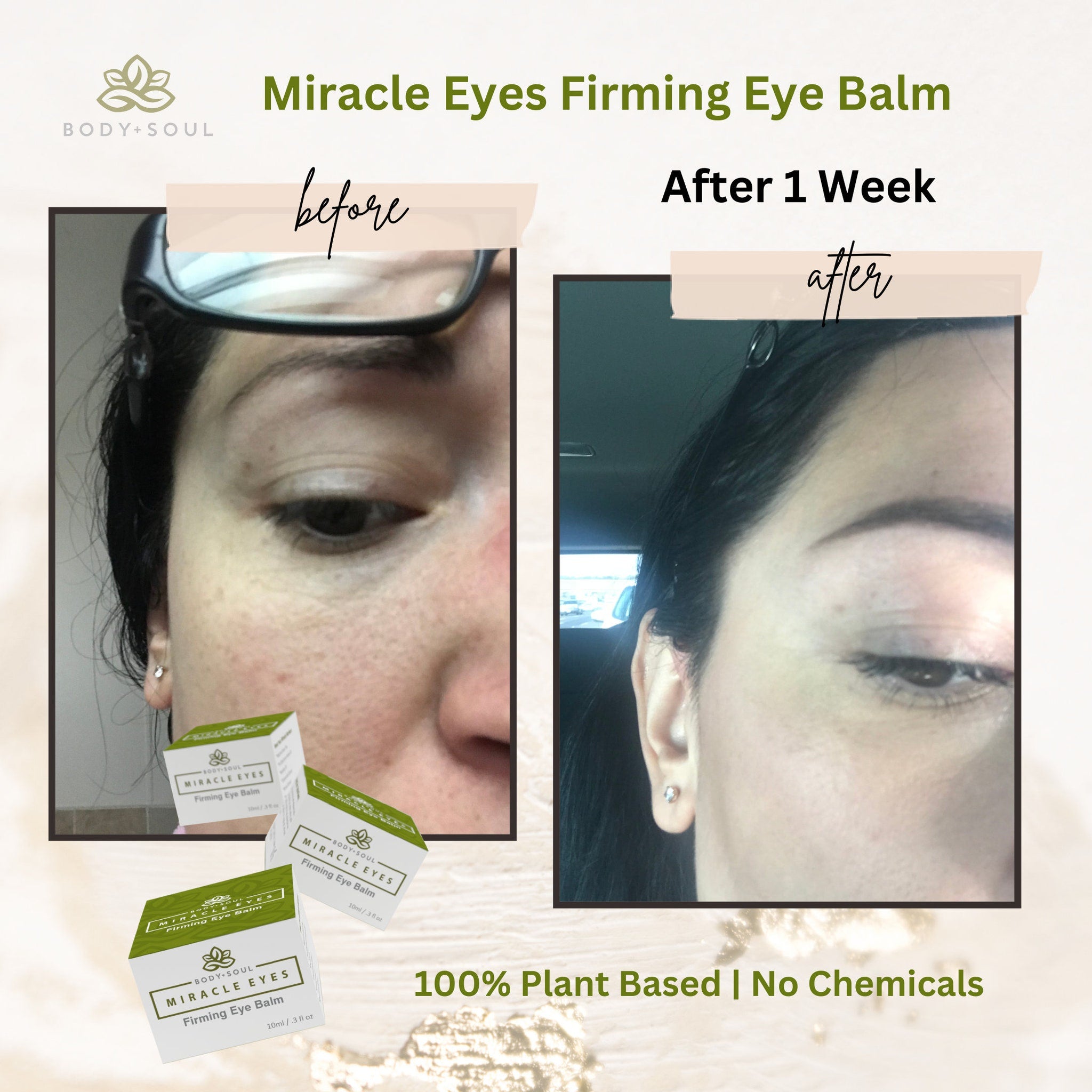 Eye balm comparison, two side-by-side photos of a face, with text "before" and "after" on a light background.