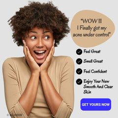 Woman smiling with hands on face, wearing beige shirt, with text bubble about acne control and AL HOOR logo