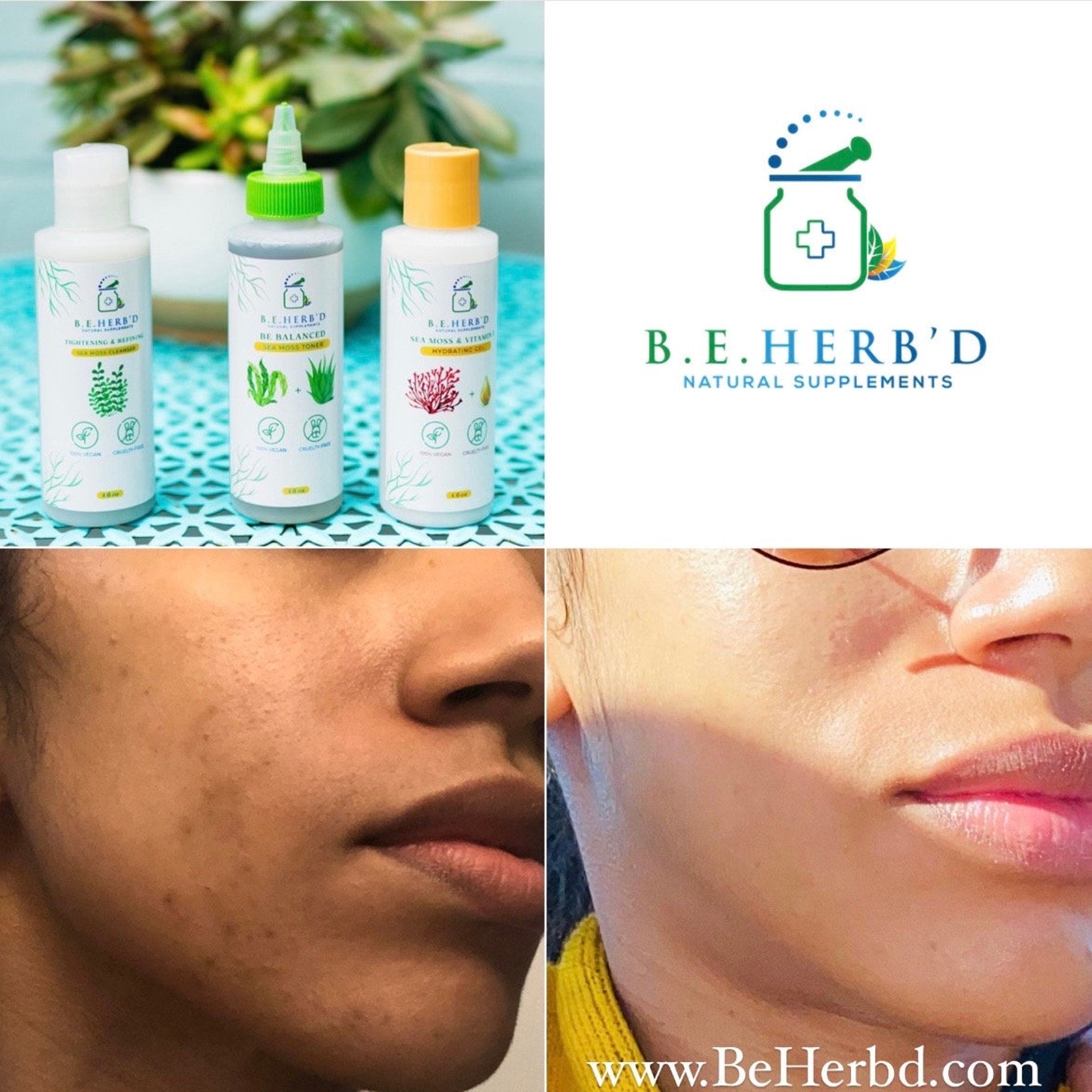 Sea moss cleanser bottles with white, green and yellow caps, B.E. Herb'd brand visible, and before and after skin comparison