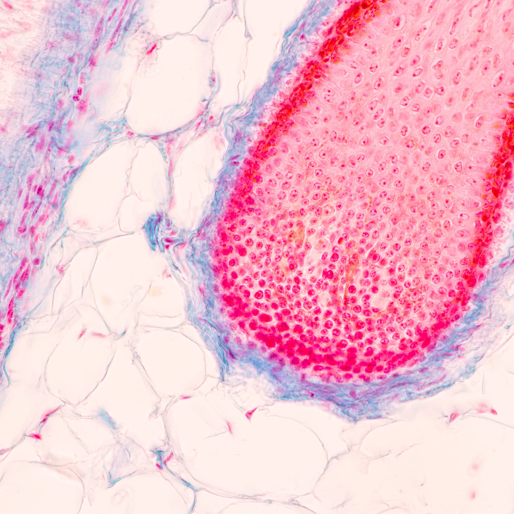 Microscopic tissue sample with pink, red, and blue color variations, cell structures visible