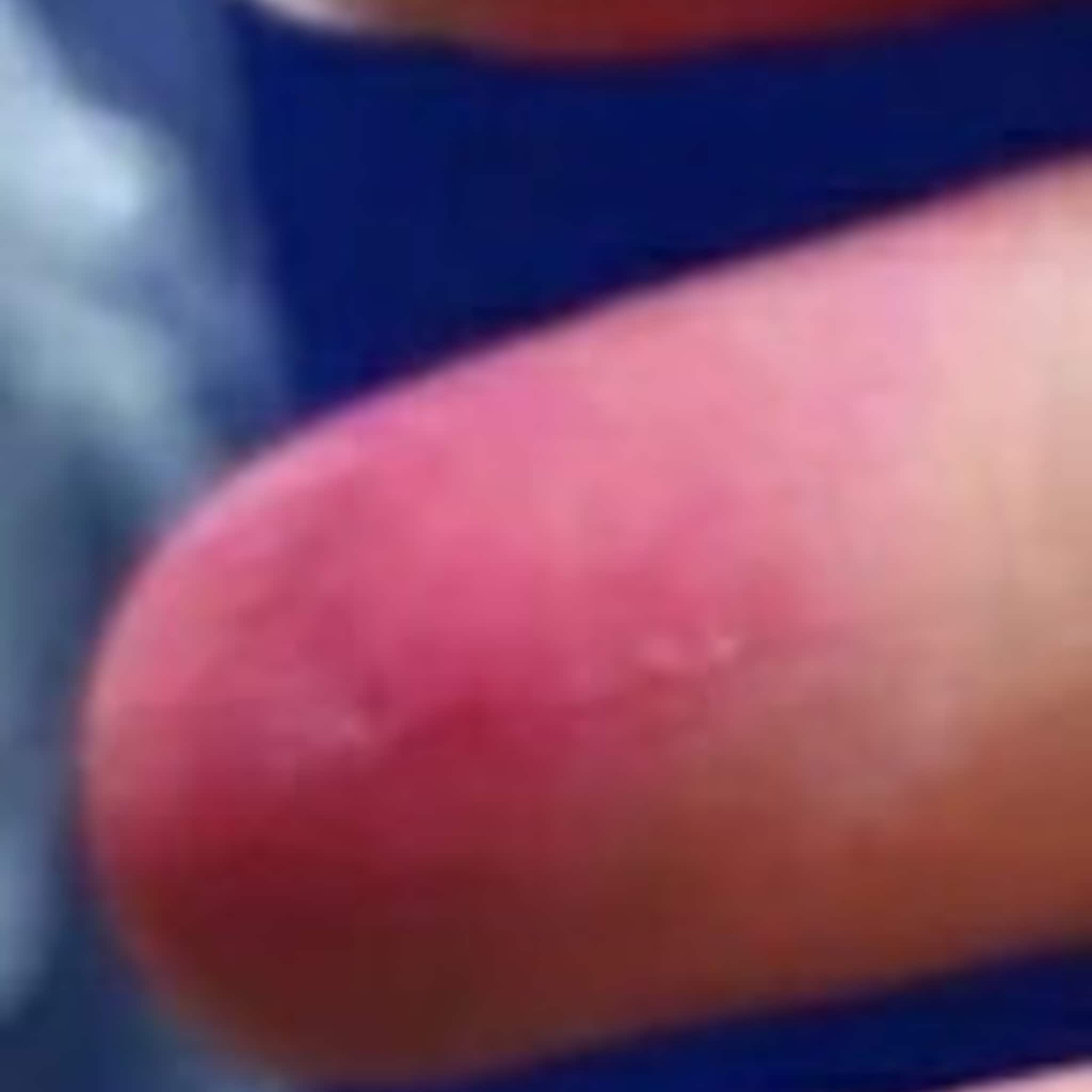 Red skin with pink and blue background, close up view of the skin