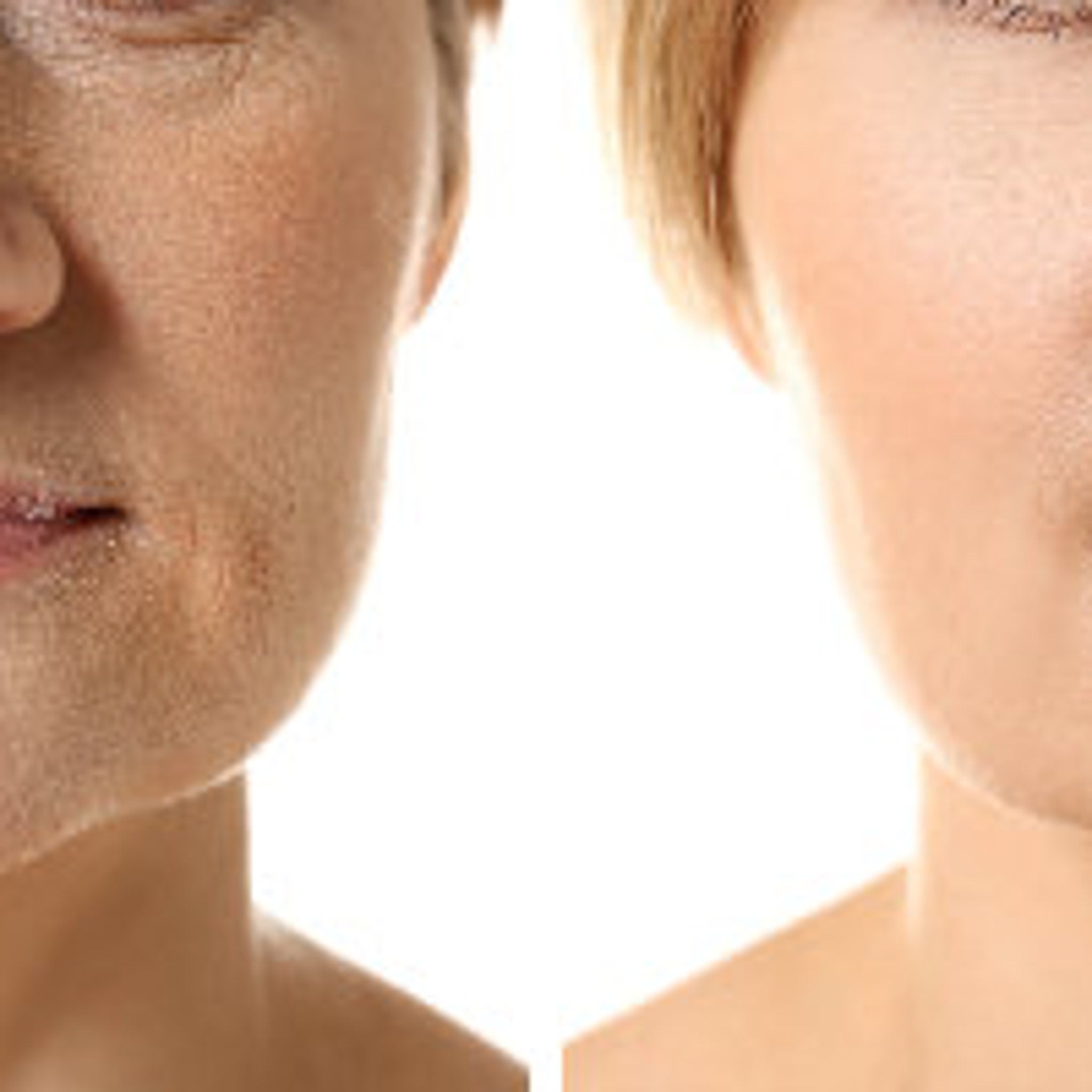 Skin comparison showing wrinkled skin next to smooth skin, with light and dark skin tones
