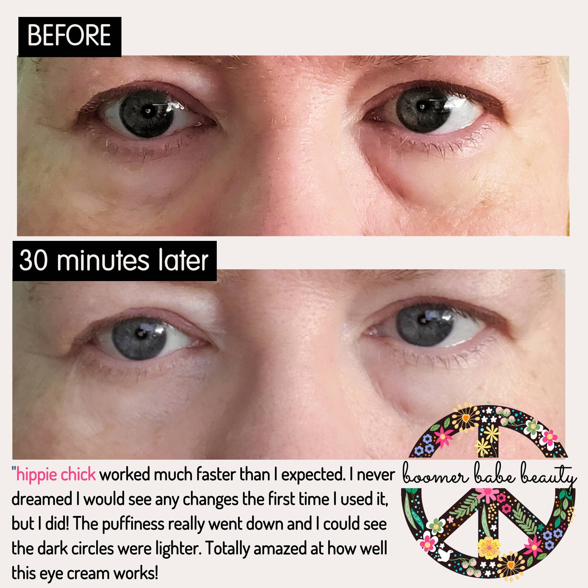 Eye area comparison before and after, showing skin texture and eye color, with Boomer Babe Beauty logo