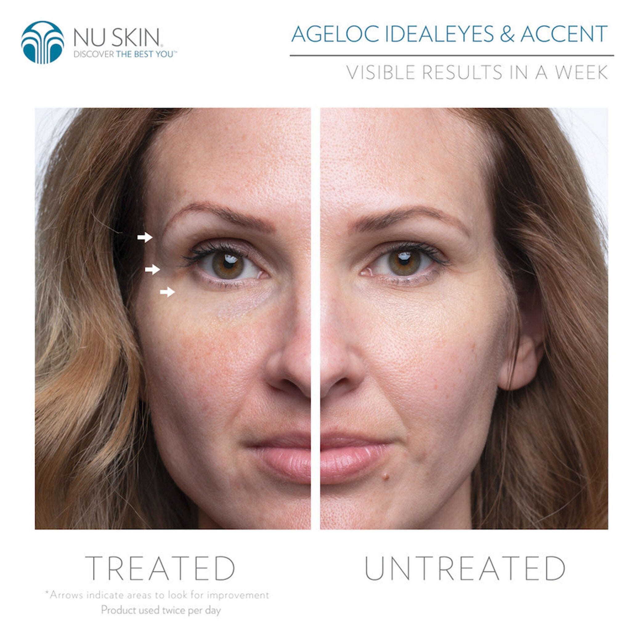 Anti-aging product comparison with side-by-side woman's face, showing skin improvement after treatment with Nu Skin product.