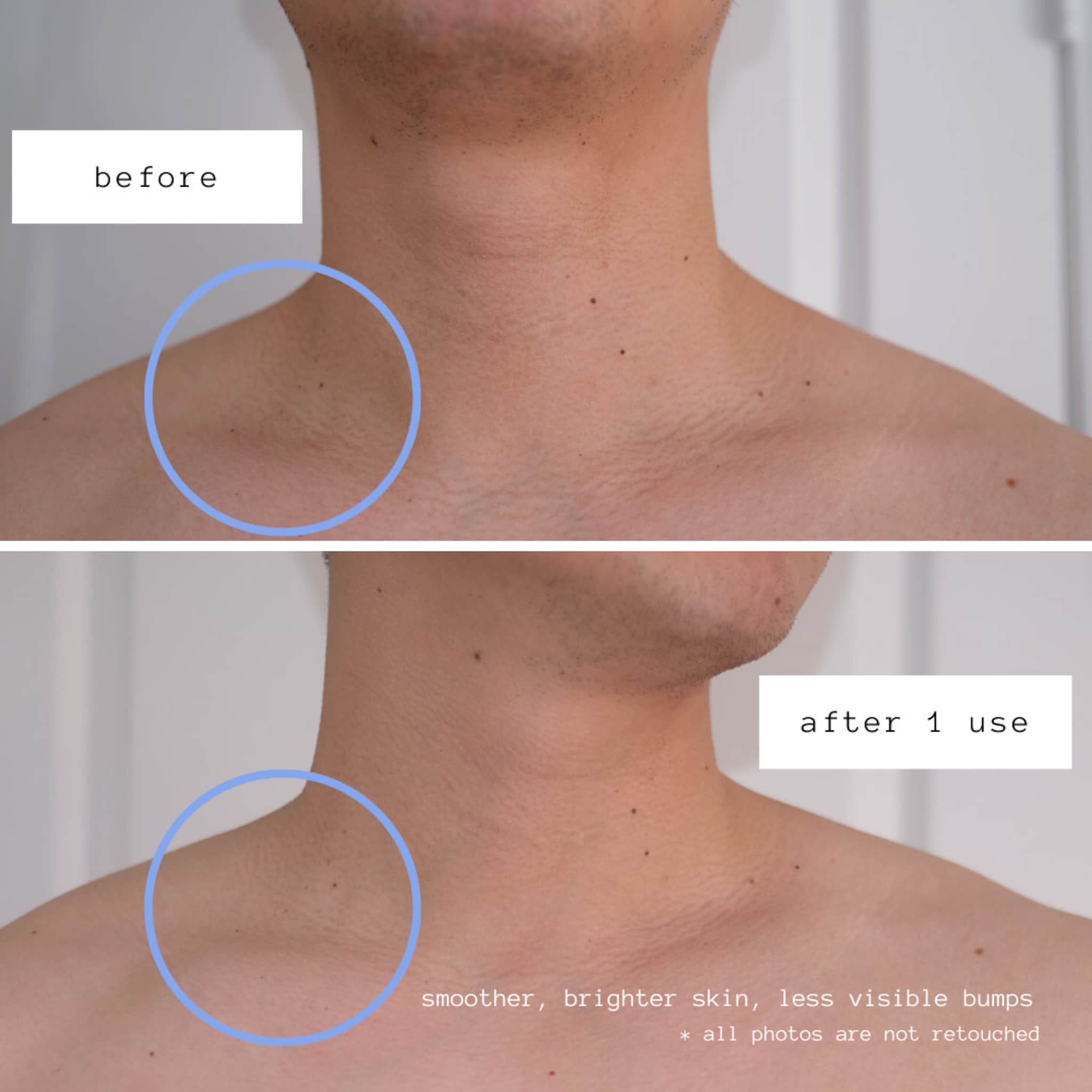 Skin comparison photo of neck, before and after use, showing skin texture changes