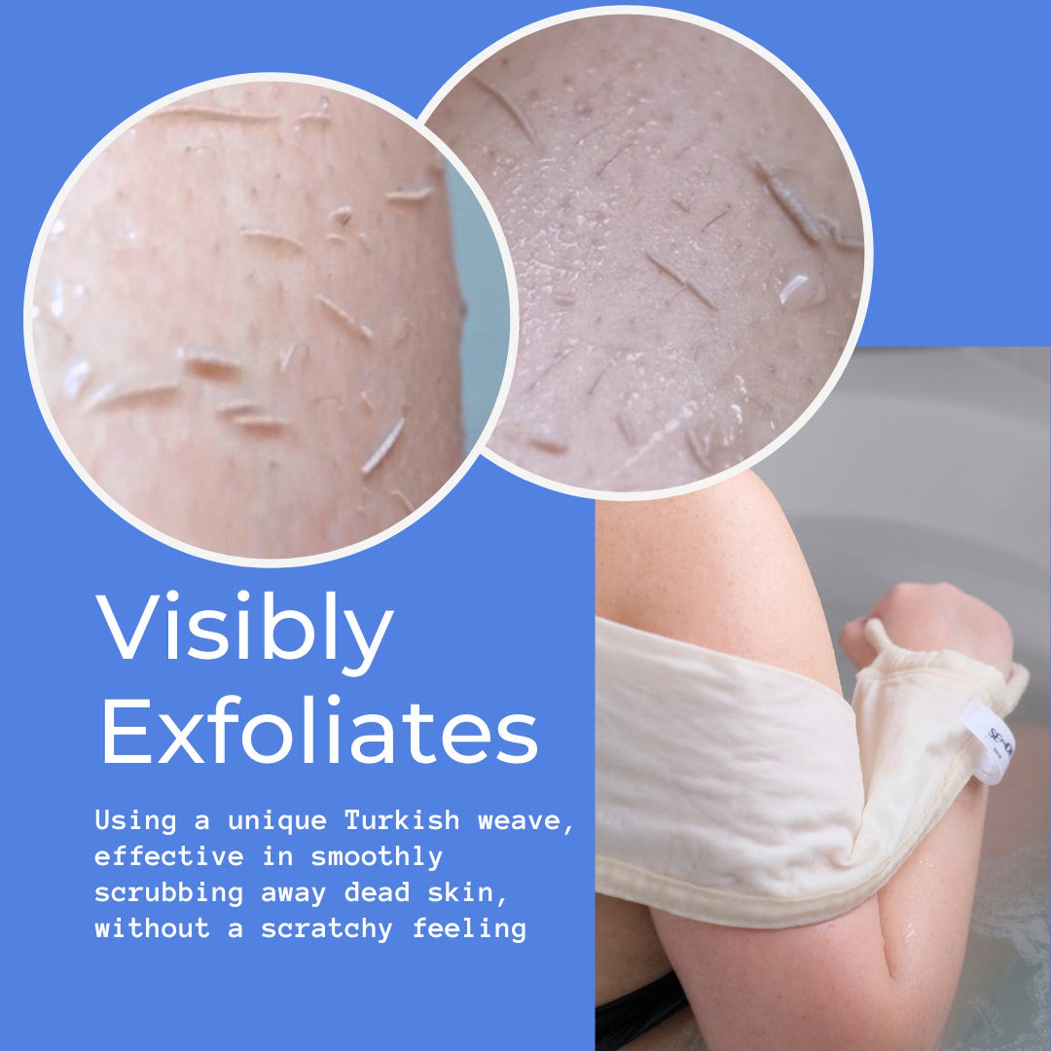 Exfoliating skin with detached skin flakes, light skin tone, and white bath glove in use