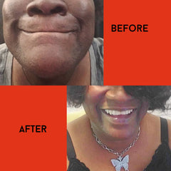 Before and after comparison of a person's face, showing skin and teeth, with text overlays