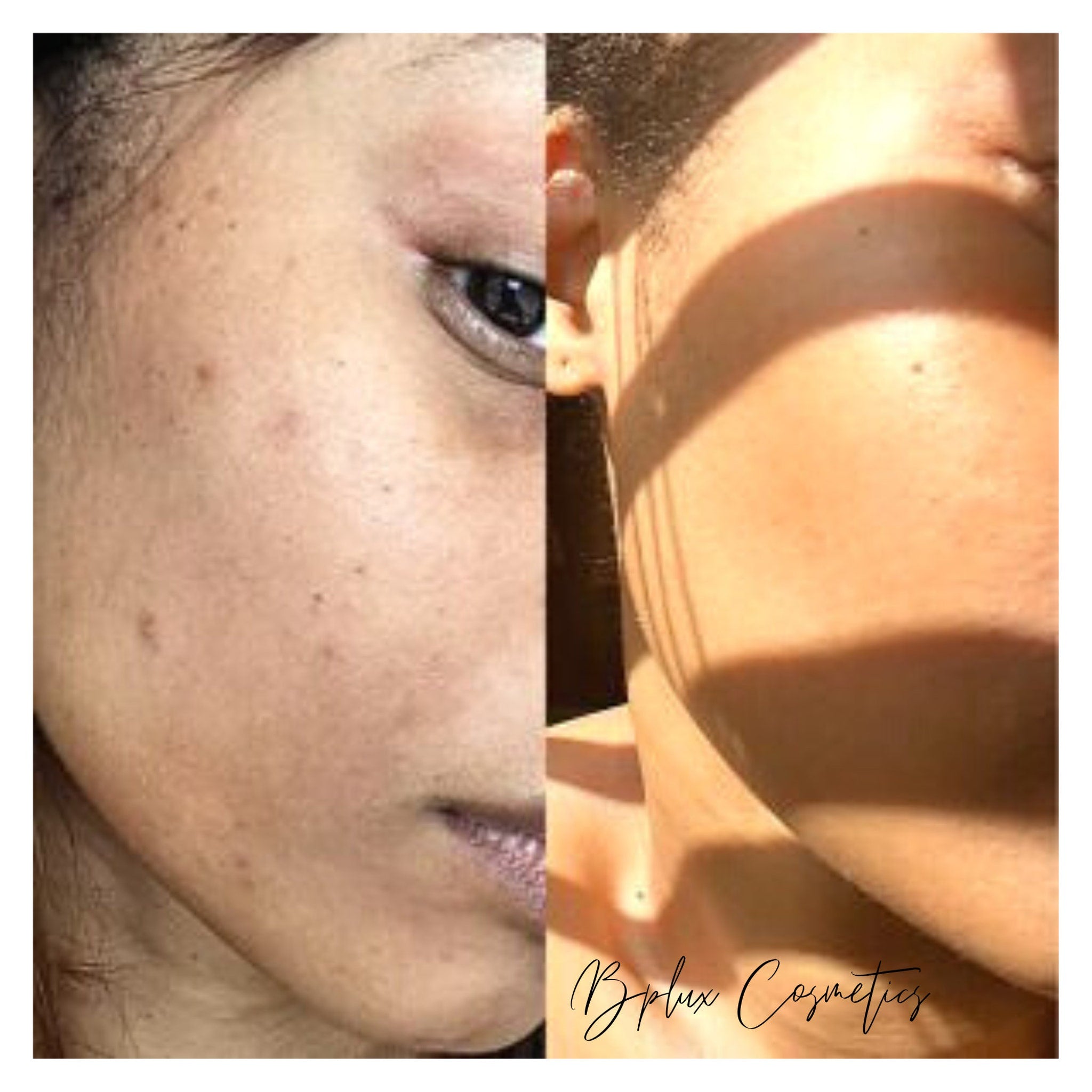 Skincare before and after comparison, showing skin tone, texture, and Bplux Cosmetics branding
