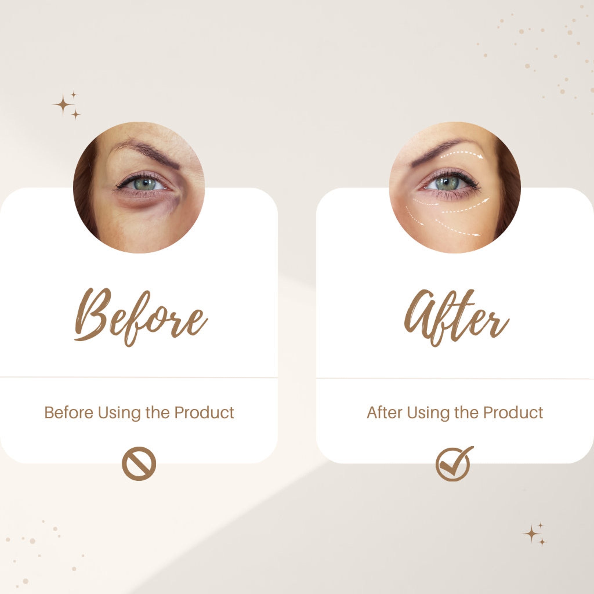 Eye comparison before and after, with two images in a white frame on beige background, with text