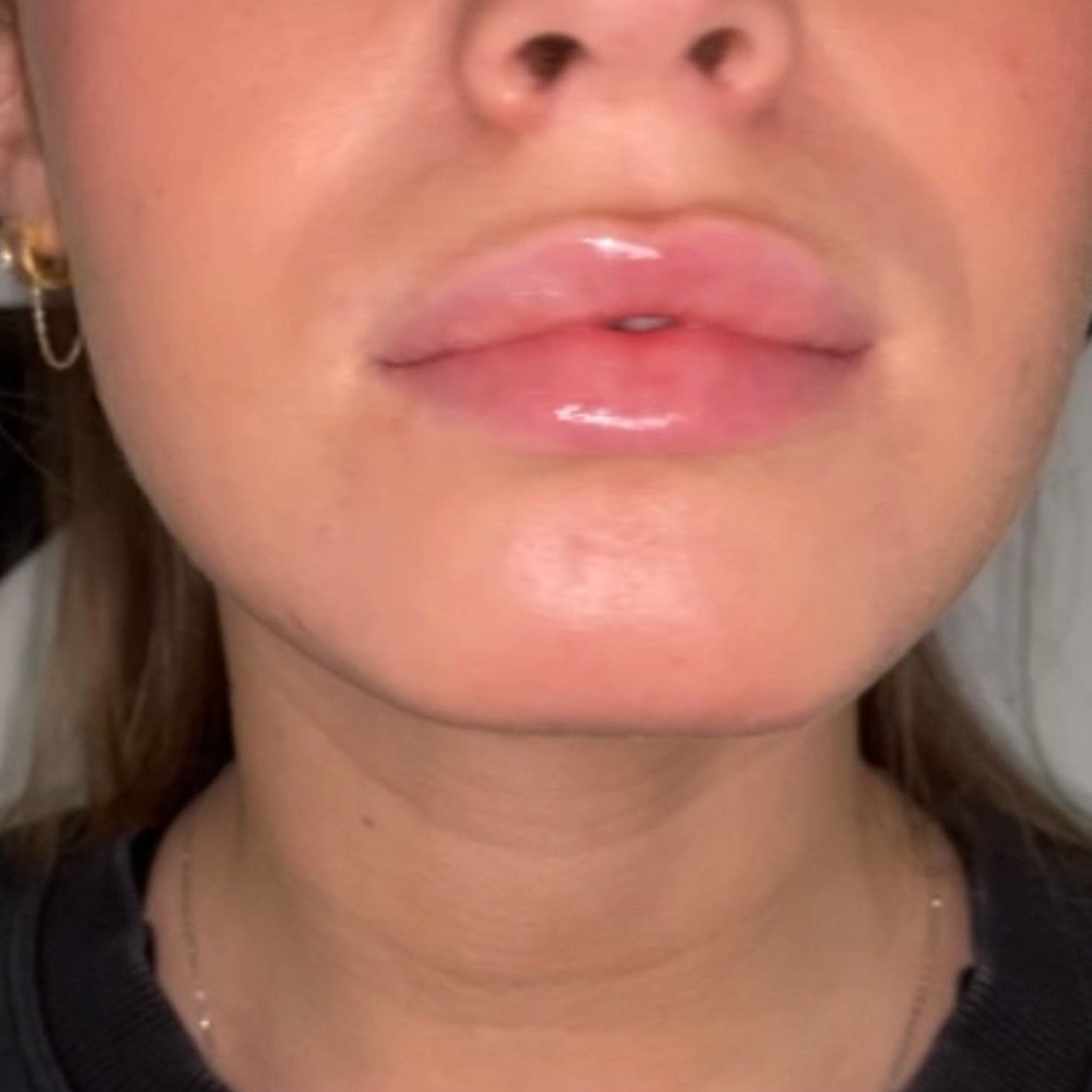 Lip gloss, glossy pink lips, close up view of face, skin tone visible