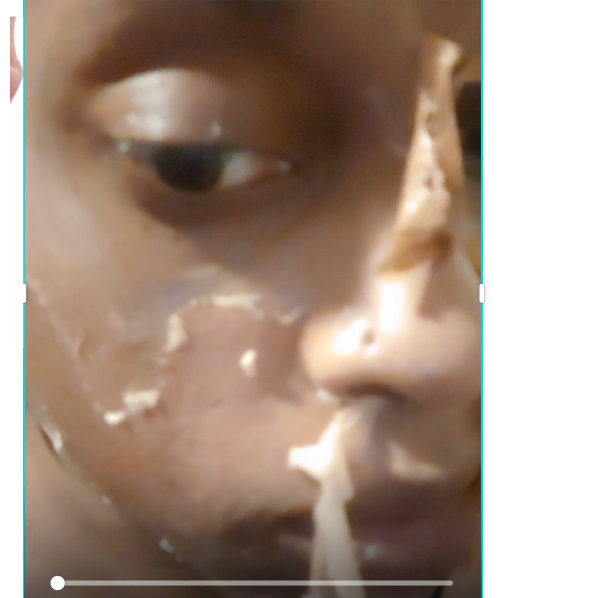 Yellow peeling oil applied to cheek using included dropper applicator on clean skin