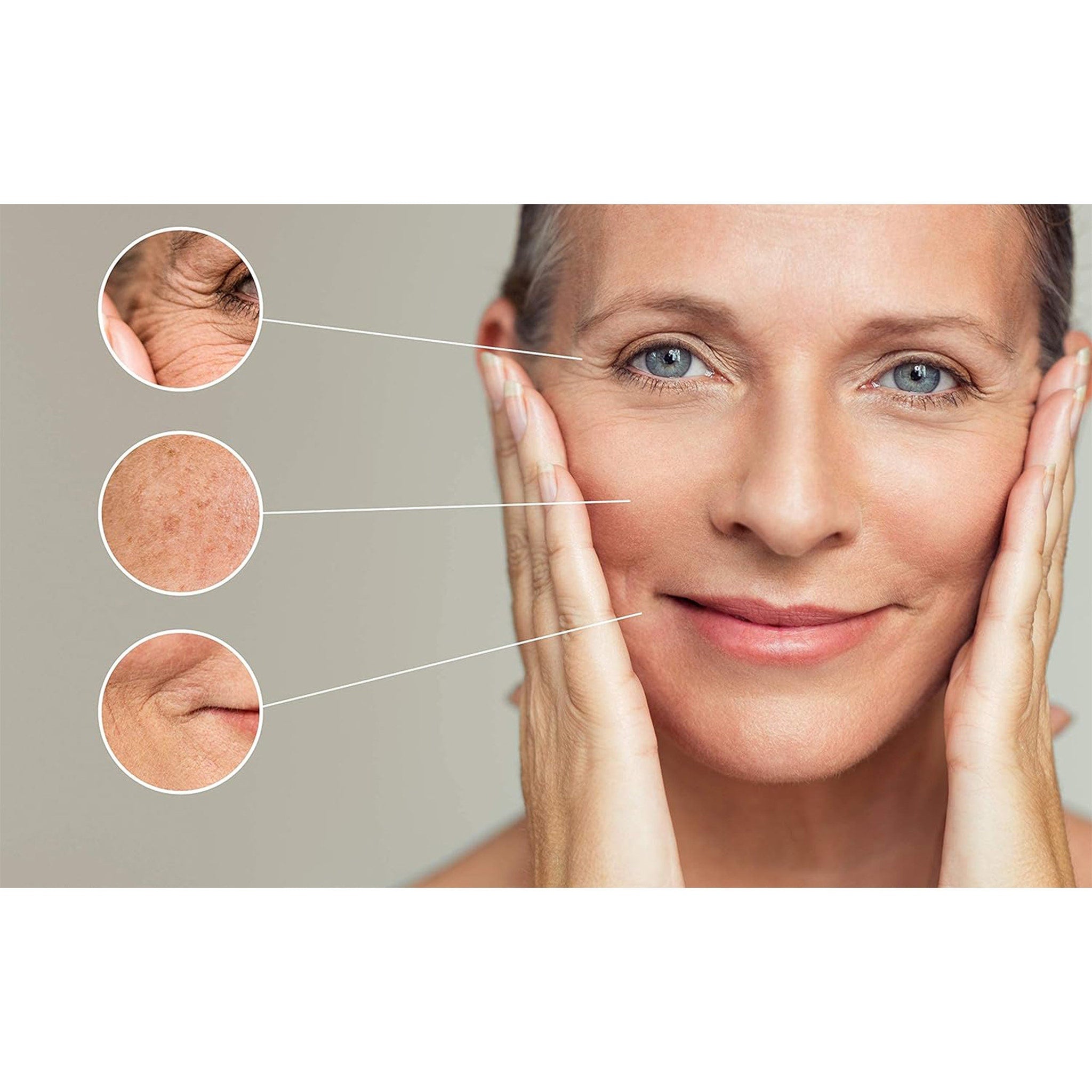 Skin aging comparison image with wrinkles, age spots, and smiling woman with blue eyes and fair skin