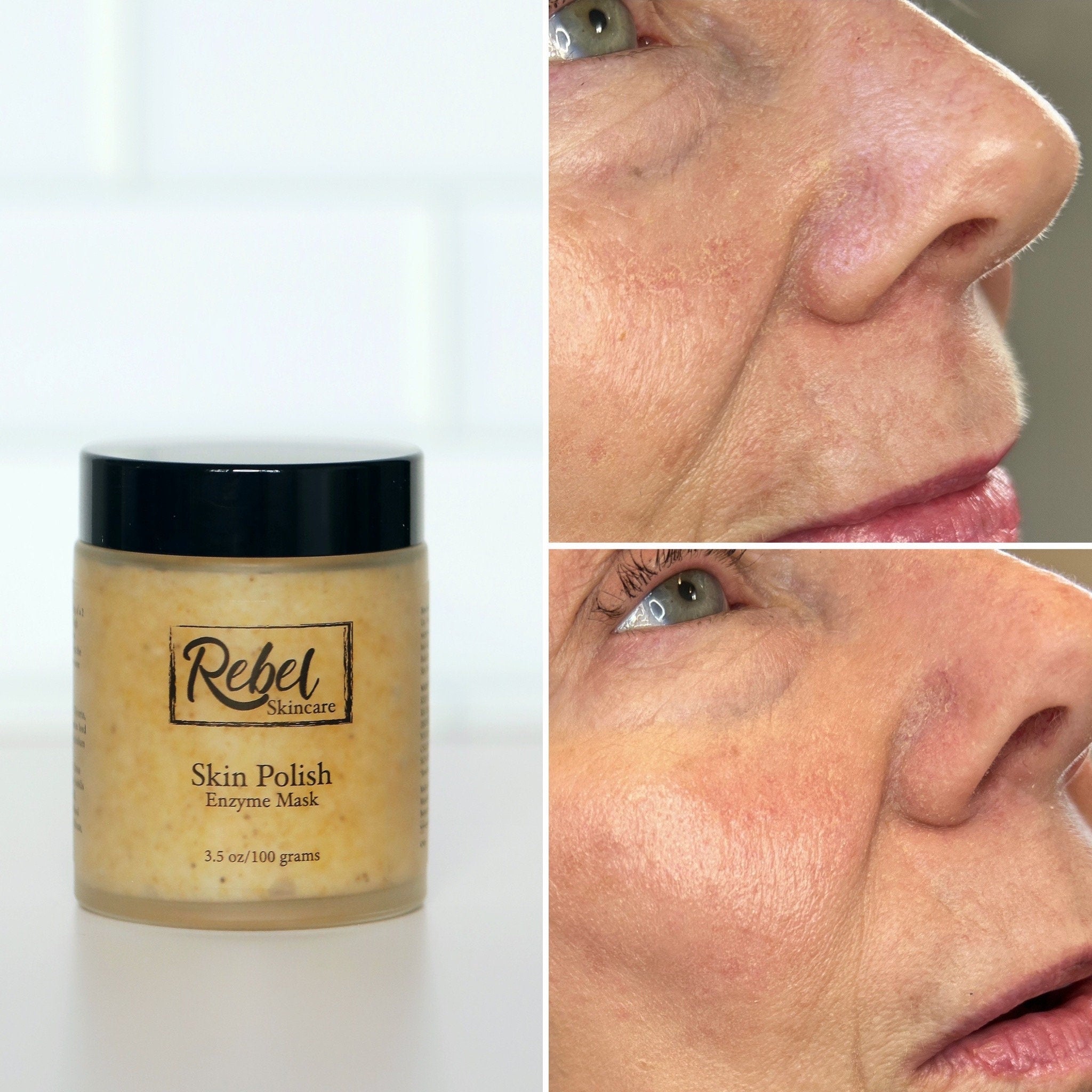 Skin care mask jar with black lid, Rebel Skincare label, and skin close-ups showing before and after use