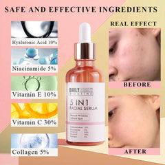 Side view of amber glass serum bottle with gold dropper, showcasing lightweight vitamin C formula against marble backdrop