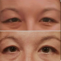 Eyes before and after, showing brown eyes, skin tone, and eyebrow shape comparison
